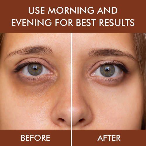 Under Eye Rejuvenating Gel 