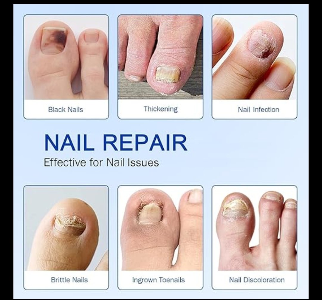 Nail Patches 