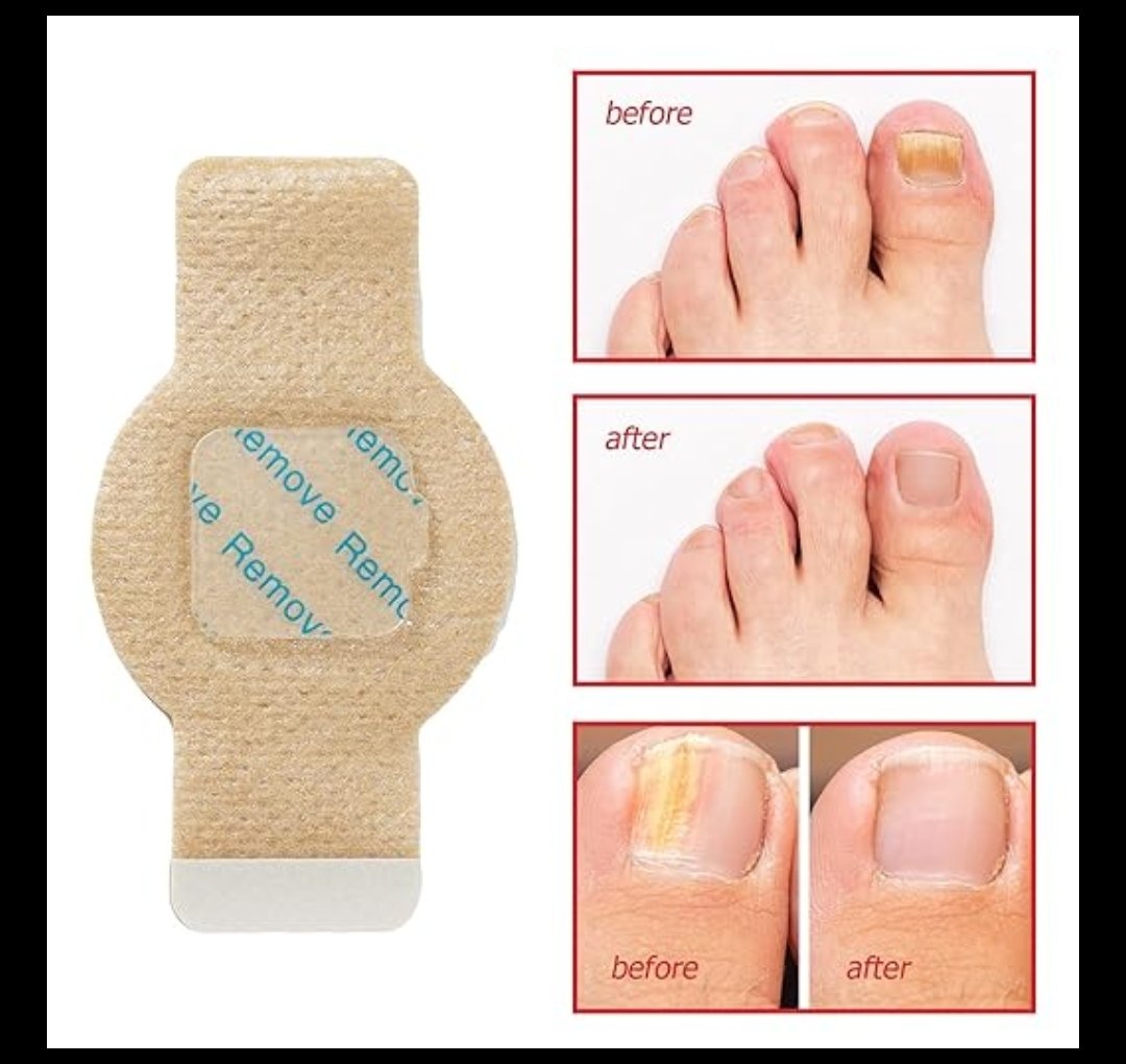 Nail Patches  - View 3