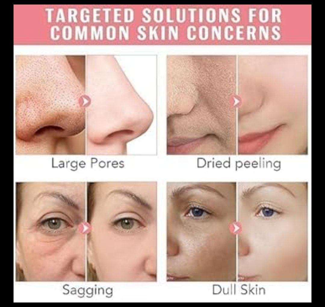 Bio Collagen Face Mask 4 Pcs Set 